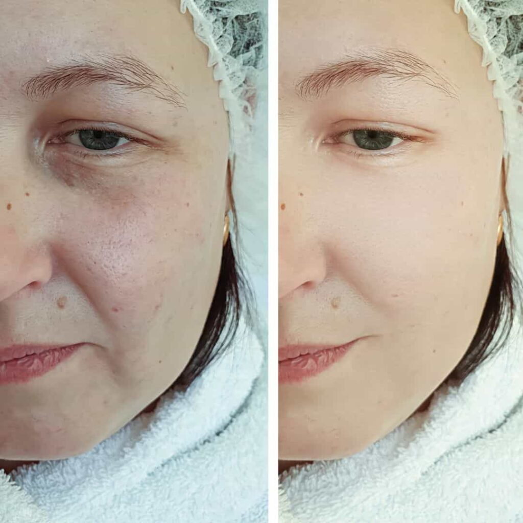 Ćwiczenia na podniesienie polczików