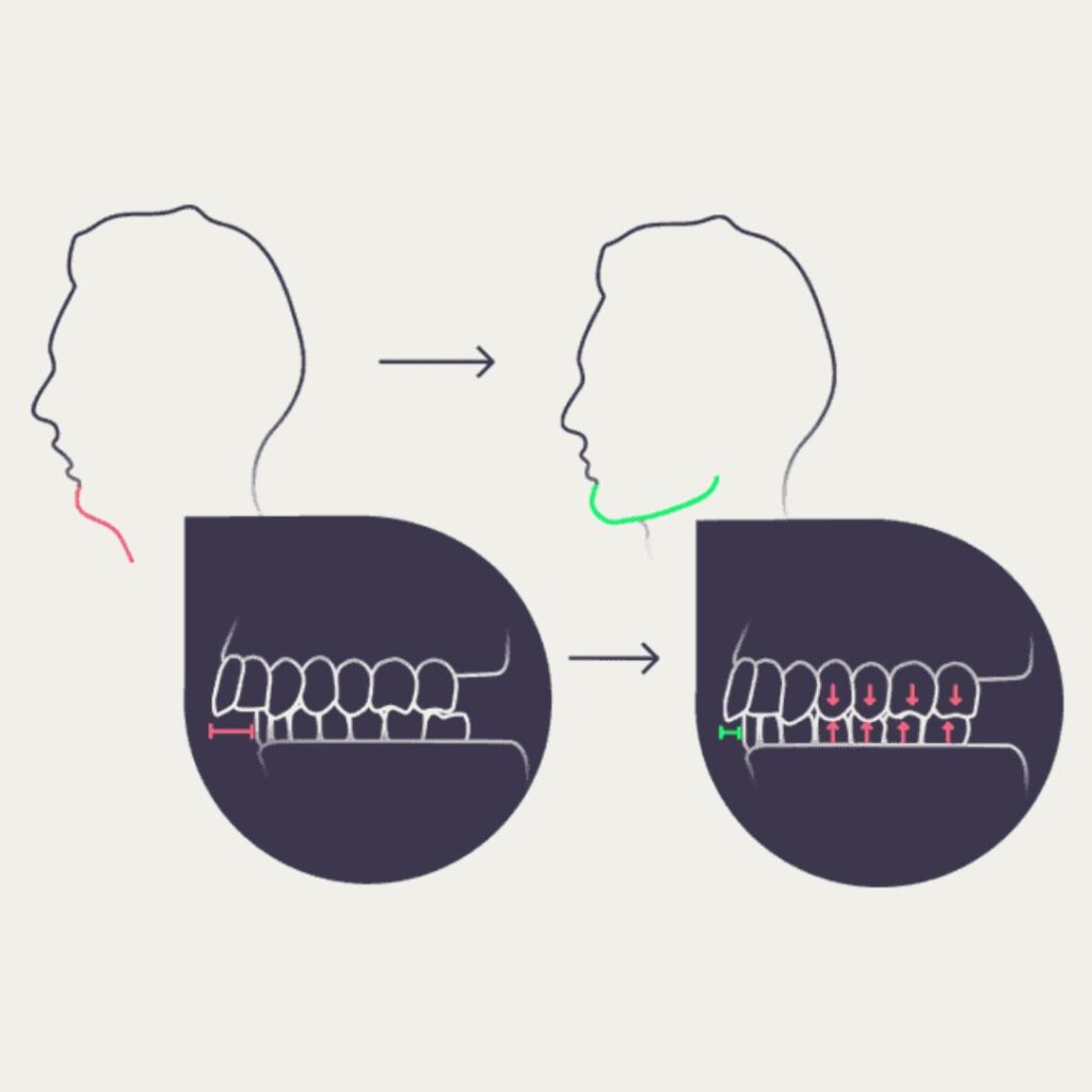 joga twarzy z VizagoJoga