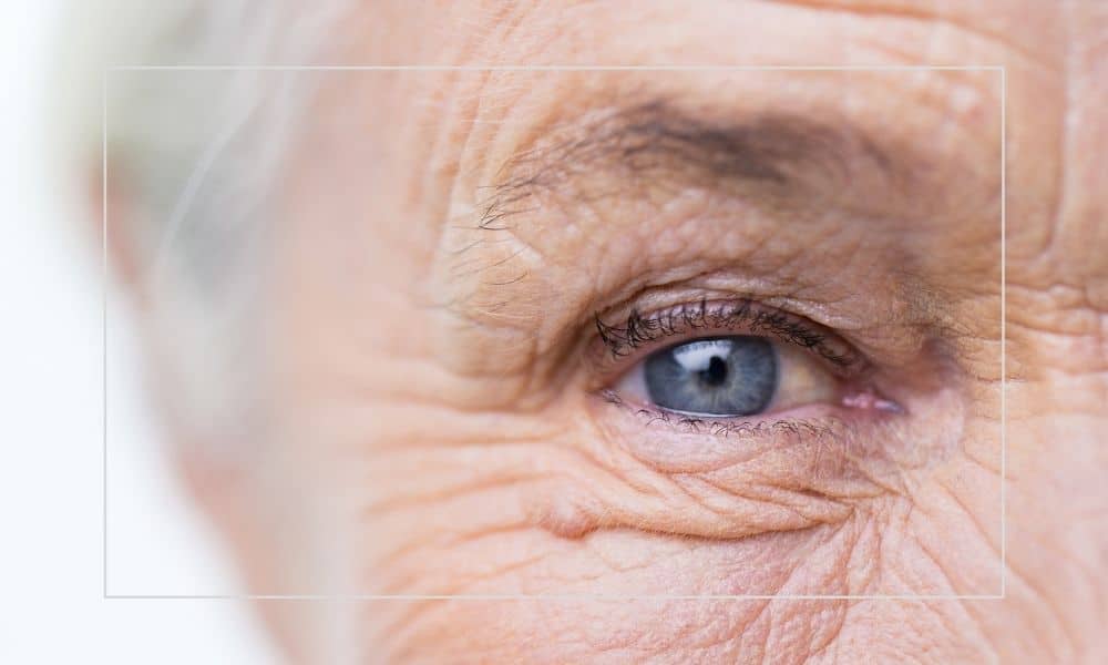 Jak Pozbyć się Zmarszczek Pod Oczami?