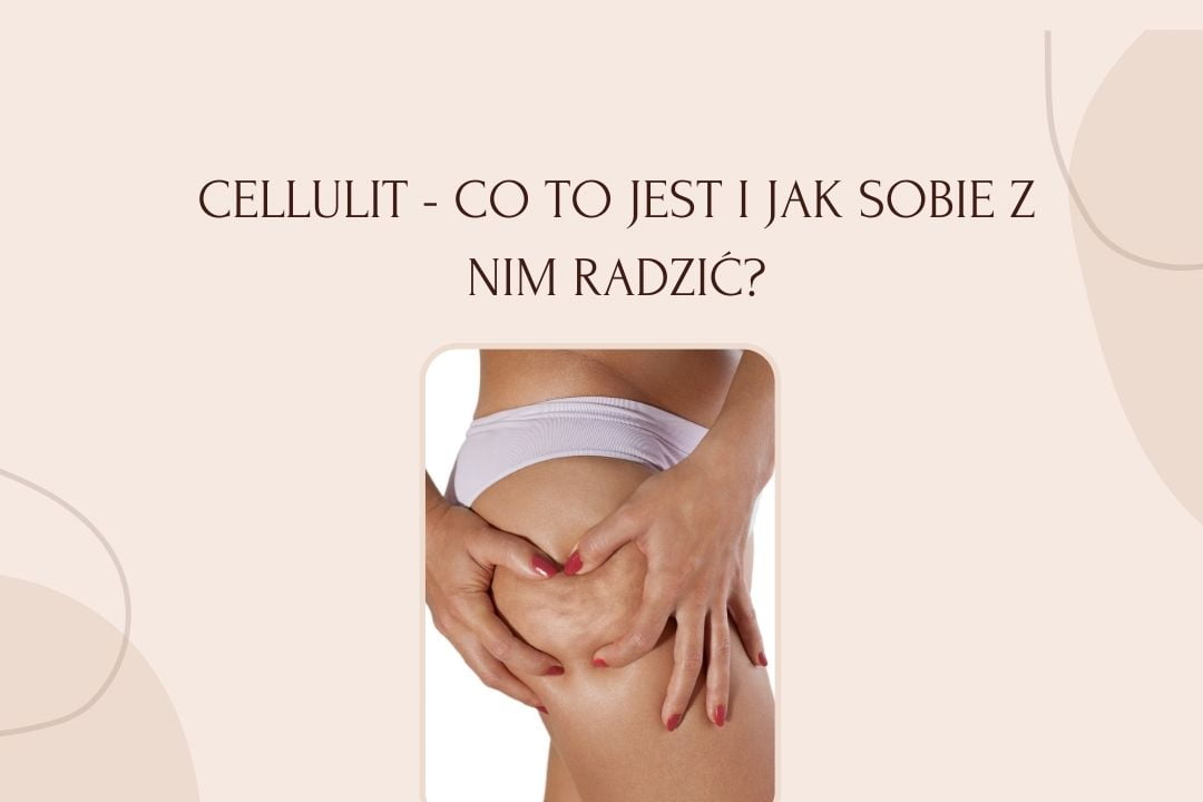 Cellulit – co to jest i jak sobie z nim radzić?